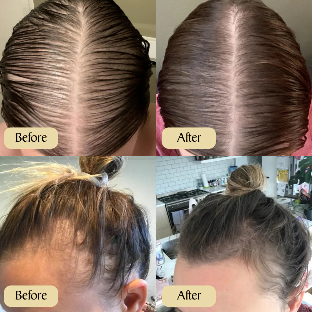 Vitalix Batana Natural Hair Growth Oil 13 Vitalix Batana Natural Hair Growth Oil