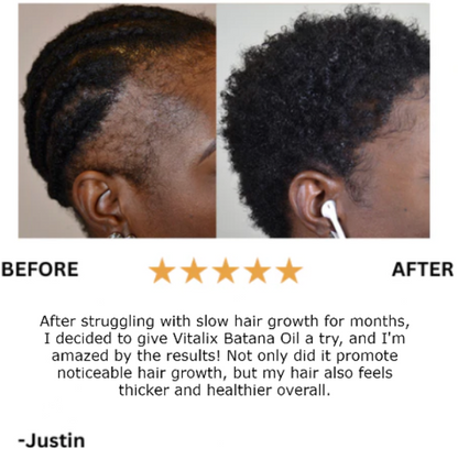 Vitalix Natural Hair Growth Oil